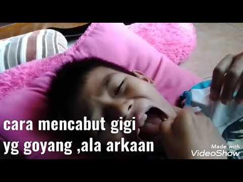 10 Jenis Makanan yang Ampuh Menguatkan Gigi yang Goyang: Mengungkap Rahasia Manfaat Alami untuk Kesehatan Gigi 10 Jenis Makanan yang Ampuh Menguatkan Gigi yang Goyang: Mengungkap Rahasia Manfaat Alami untuk Kesehatan Gigi
