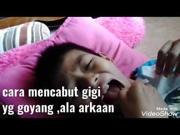 Teknik Menguatkan Gigi Goyang secara Alami